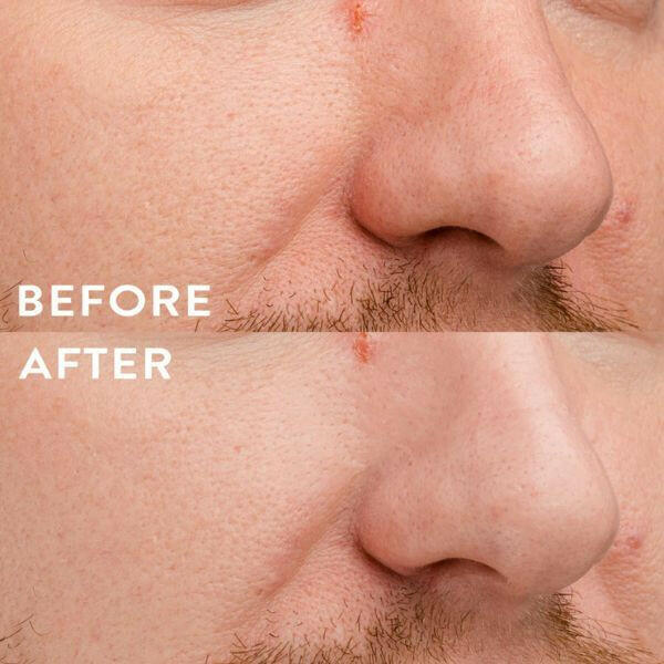 WBCo Hydro-Patch | 6 pactches in a pack GOODS Superdrug