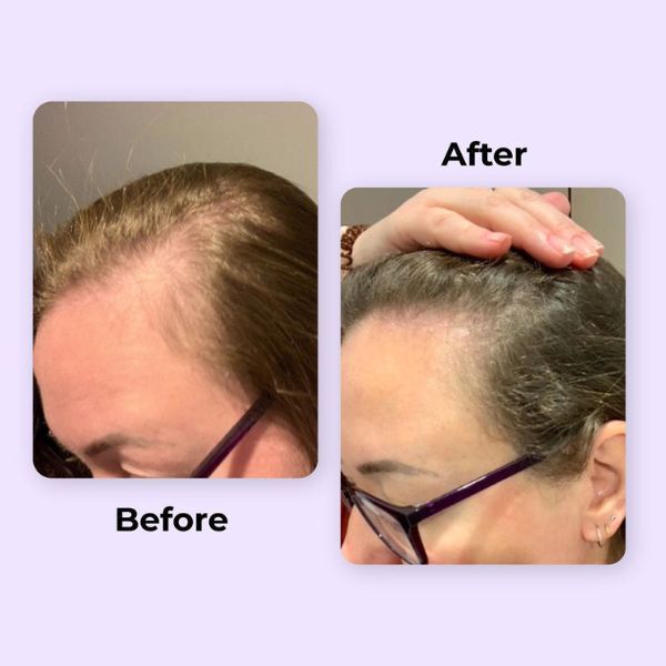 Ayumi Naturals Rosemary Hair Oil 100ml - McGrocer