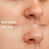 WBCo Hydro-Patch | 6 pactches in a pack GOODS Superdrug