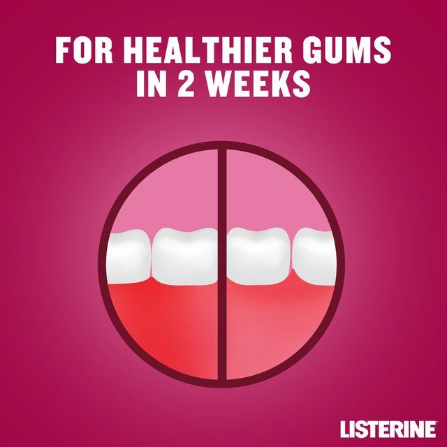 Listerine Advanced Defence Gum Treatment Crisp Mint Mouthwash 500ml