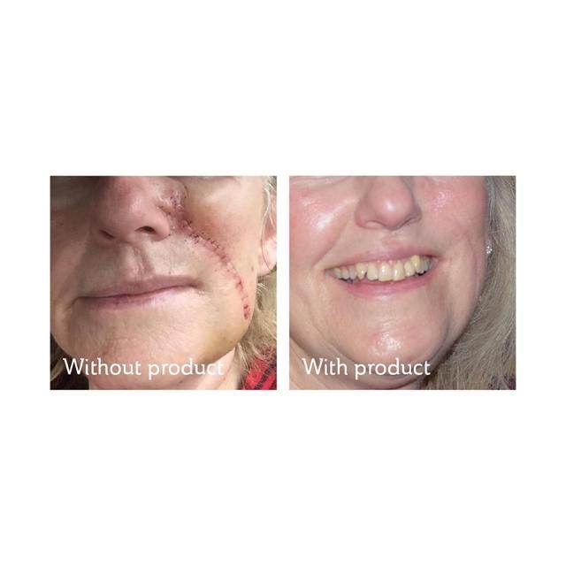 Science of Skin Solution for Scars 30ml