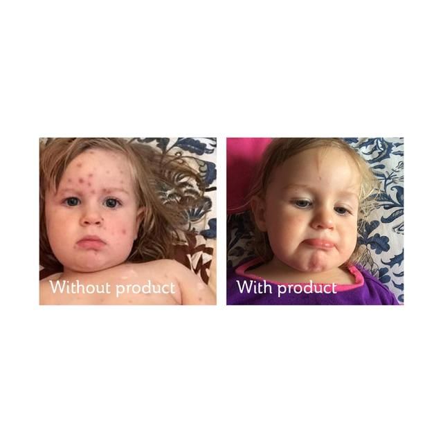 Science of Skin Solution for Scars   30ml